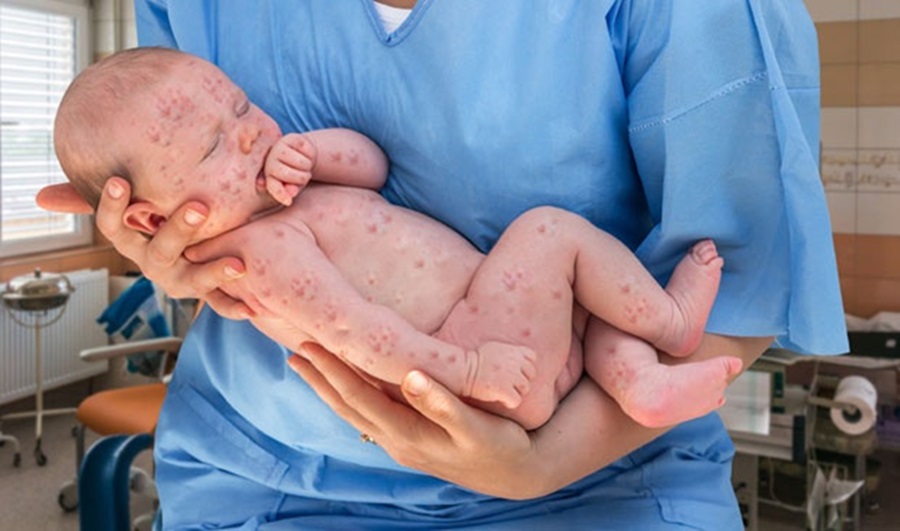 Фото: Thinkstock