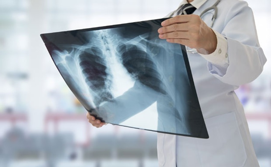 Thinkstock-